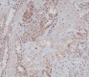IHC staining of FFPE human kidney with CD9 antibody. HIER: boil tissue sections in pH 9 EDTA for 20 min and allow to cool before testing.