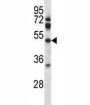 Pdk4 antibody western blot analysis in mouse lung tissue lysate.