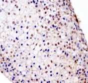 Fgfr1 antibody immunohistochemistry analysis in formalin fixed and paraffin embedded mouse adrenal glands.