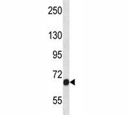 Fgfr1 antibody western blot analysis in NCI-H460 lysate. Predicted molecular weight: 75-160 kDa depending on glycosylation level.~