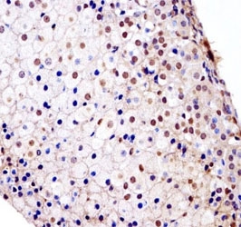 Fgfr1 antibody immunohistochemistry analysis in formalin fixed and paraffin embedded mouse adrenal gland