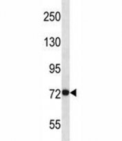 FGFR3 antibody western blot analysis in 293 lysate. Predicted molecular weight: 87-135 kDa depending on glycosylation level.