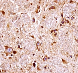FGFR3 antibody immunohistochemistry analysis in formalin fixed and paraffin embedded mouse brain tissue.~