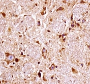 FGFR3 antibody immunohistochemistry analysis in formalin fixed and paraffin embedded mouse brain tissue.