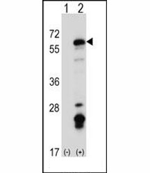 Western blot analysis of Fyn antibody and 293 cell lysate (2 ug/lane) either nontransfected (Lane 1) or transiently transfected (2) w