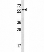 Fyn antibody western blot analysis in mouse lung tissue lysate. Predicted molecular weight: ~59 kDa.
