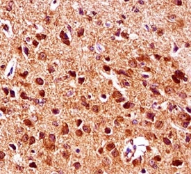Gsk3b antibody immunohistochemistry analysis in formalin fixed and paraffin embedded mouse brain tissue.~