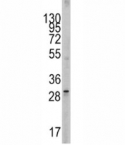 Western blot analysis of SCF antibody and 293 lysate. Expected molecular weight ~31 kDa (unmodified), 37-42 kDa (glycosylated).