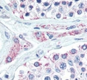 IHC analysis of FFPE human testis tissue stained with LIN28B antibody