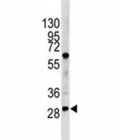 Western blot analysis of LIN28B antibody and HL-60 lysate. Predicted molecular weight ~27 kDa.