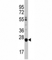 Western blot analysis of LIN28B antibody and HL-60 lysate. Predicted molecular weight ~27 kDa.