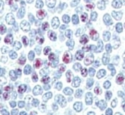 IHC analysis of FFPE human spleen tissue stained with LIN28B antibody