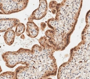 IHC analysis of FFPE human placental tissue stained with LIN28B antibody. HIER: boil tissue sections in pH 9 EDTA for 20 min and allow to cool before testing.