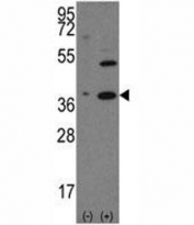 Western blot analysis of NANOG antibody and 293 cell lysate (2 ug/lane) either nontransfected (Lane 1) or transiently transfected with the human gene (2). Predicted molecular weight: 35-45 kDa.