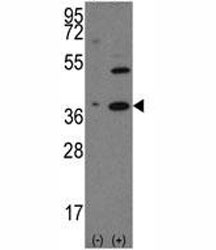 Western blot analysis of NANOG antibody and 293 cell lysate (2 ug/lane) either nontransfected (Lane 1) or transiently transfected with the human gene (2). Predicted molecular weight: 35-45 kDa.