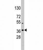 Western blot analysis of NANOG antibody and K562 lysate; Predicted molecular weight: 35-45 kDa.