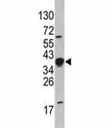 Western blot analysis of NANOG antibody and HepG2 lysate. Predicted molecular weight: 35-45 kDa.