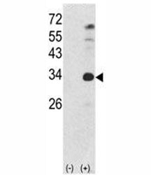 Western blot analysis of NANOG antibody and 293 cell lysate (2 ug/lane) either nontransfected (Lane 1) or transiently transfected with the human gene (2). Predicted molecular weight: 35-45 kDa.