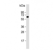 Western blot analysis of GLUT2 antibody and human Jurkat cell lysate. Expected molecular weight: 57~70 kDa depending on glycosylation level.