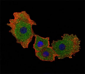 Fluorescent confocal image of MCF-7 cell stained with SMAD9 antibody at 1:25. SMAD9 immunoreactivity is localized to the cytoplasm and nucleus.~