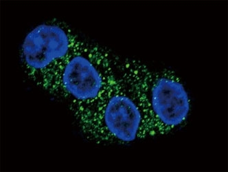 Confocal immunofluorescent analysis of ABCG2 antibody with HepG2 cells followed by Alexa Fluor 488-conjugated goat anti-rabbit lgG (green). DAPI was used as a nuclear counterstain (blue).