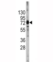 Western blot analysis of ABCG2 antibody and 293 lysate