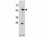 Western blot analysis of placental Alkaline Phosphatase antibody and 293 cell lysate (2 ug/lane) either nontransfected (Lane 1) or transiently transfected (2) with the ALPP gene.
