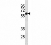 Placental Alkaline Phosphatase antibody western blot analysis in HepG2 lysate