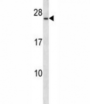 CD79a antibody western blot analysis in CEM lysate. Predicted/Observed molecular weight: 25~47 kDa depending on glycosylation level