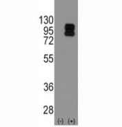 Western blot analysis of CD19 antibody and 293 cell lysate (2 ug/lane) either nontransfected (Lane 1) or transiently transfected with the CD19 gene (2).   Expected size is 60~100 kDa depending on glycosylation level.