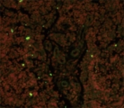 Immunofluorescence analysis of CD19 antibody with paraffin-embedded human lymph tissue. Primary Ab was followed by FITC-conjugated goat anti-rabbit lgG (whole molecule). FITC emits green fluorescence. Red counterstaining is PI.