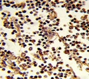 IHC analysis of FFPE human lymph stained with CD19 antibody