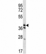 KLF2 antibody western blot analysis in mouse heart tissue lysate. Predicted molecular weight ~38 kDa.