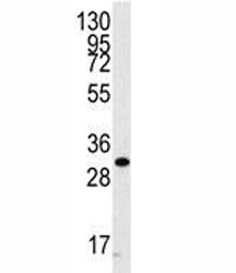 Western blot analysis of CDC2 antibody and A2058 cell lysate. Predicted molecular weight ~34 kDa.~