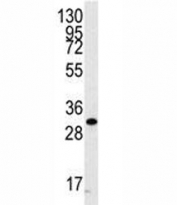 Western blot analysis of CDC2 antibody and A2058 cell lysate. Predicted molecular weight ~34 kDa.