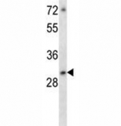 ATF5 antibody western blot analysis in MCF-7 lysate. Predicted molecular weight: ~31kDa.