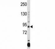 Dnmt3a antibody western blot analysis in HL-60 lysate
