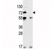 Western blot analysis of anti-TLR2 antibody pre-incubated without and with blocking peptide in CEM lysate. Predicted molecular weight: 85-90 kDa.