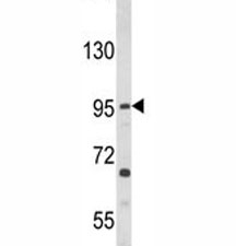 Western blot analysis of TLR3 antibody and HL-60 lysate.~
