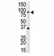 Western blot analysis of anti-TLR4 antibody and mouse spleen cell lysate