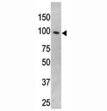 TLR5 antibody used in western blot to detect TLR5 in HL-60 cell lysate~