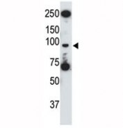 TLR5 antibody used in western blot to detect TLR5 in HL-60 cell lysate