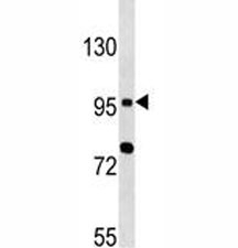 TLR6 antibody western blot analysis in MCF-7 lysate~