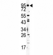 Western blot analysis of TLR6 antibody and K562 lysate