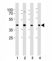 Western blot analysis of lysate from (1) HeLa, (2) U-87 MG, (3) rat C6 cell line and (4) mouse heart tissue lysate using Connexin 43 antibody at 1:1000. Predicted molecular weight: 43 kDa