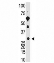 Recoverin antibody used in western blot to detect Recoverin in Y79 cell lysate