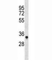 Aurkb antibody western blot analysis in Ramos lysate. Predicted molecular weight: 33-39 kDa.