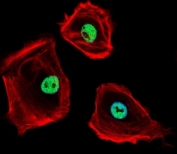 Fluorescent confocal image of SK-BR-3 cells stained with CTBP1 antibody. Alexa Fluor 488 secondary was used (green). CTBP1 immunoreactivity is localized to the nucleus.