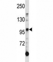 AXL antibody western blot analysis in K562 lysate. Predicted molecular weight is 104 kDa unglycosylated, 120-140 kDa with glycosylation