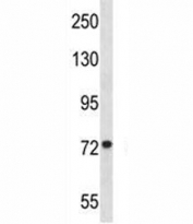 MFN1 antibody western blot analysis in Jurkat lysate.